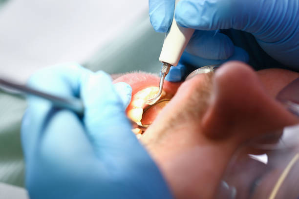 Best Knocked-Out Tooth Emergency  in Trophy Clu, TX