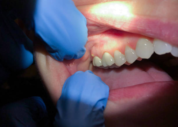 Best Urgent Tooth Repair  in Trophy Clu, TX