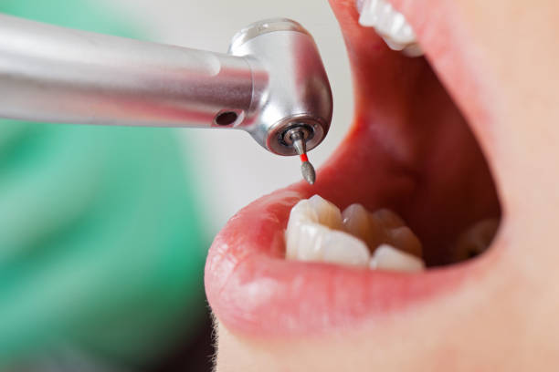 Best Emergency Tooth Extraction  in Trophy Clu, TX